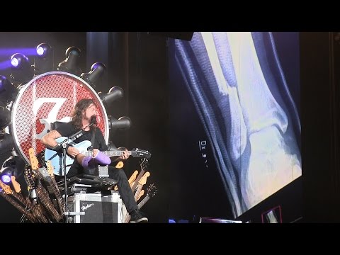 Foo Fighters 20th Anniversary Blowout- &quot;Big Me&quot; *Dave Tells Story of His Broken Leg* on July 4, 2015